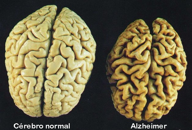 O Que Está no Interior do Cérebro do AlphaZero? 